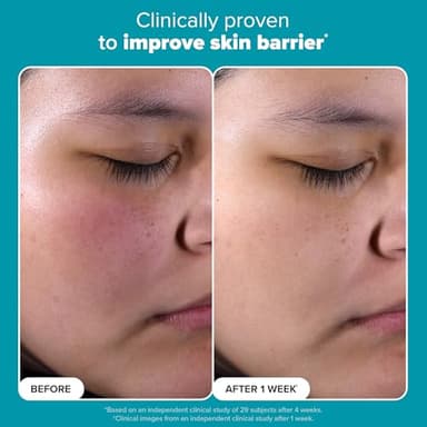 Paulas Choice--SKIN PERFECTING 2% BHA Liquid Salicylic Acid Exfoliant--Facial Exfoliant for Blackheads, Enlarged Pores, Wrinkles & Fine Lines, 4 oz Bottle - Image 5