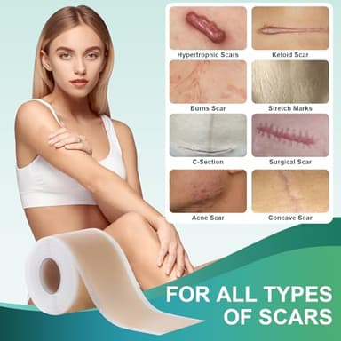 Medical Grade Silicone Scar Sheets, Silicone Scar Tape (1.6”x 60” Roll-1.5M), Professional Scar Removal Treatment, Reusable Silicone Scar Strip for Keloid, C-Section, Surgery, Burns, Acne Etc - Image 6