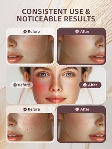 INTEO Facial Massager Tool, Beauty Device for Face and Full Body, Portable Face Lift Device for Skin Care, Against Dullness, Neck Massager for Women - Image 3