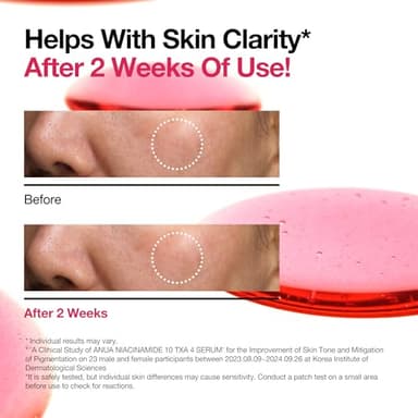 ANUA Niacinamide 10 + TXA 4 Serum, Hyaluronic Acid, Tranexamic acid, Facial Serum for Glass Skin, Clarifying, Radiant Complexion with Natural Color, Korean Skin Care (30ml /1.01 fl.oz) - Image 6