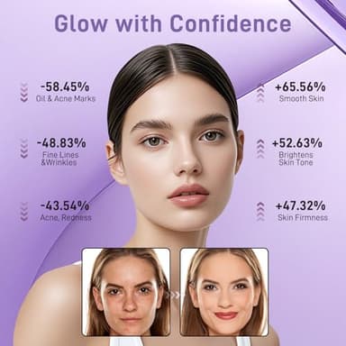 Lovsheme LED Face Mask Light Therapy - Professional Grade Skincare at Home – Red Light Therapy for Face for Acne, Wrinkles, Skin Rejuvenation – 3 Light Modes - Remote Control - includes Eye Protection - Image 2