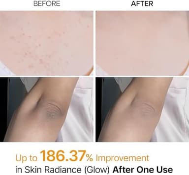 Dr.Melaxin Body Keratin Care Kojic Acid Turmeric Spray Gently Exfoliating Peeling Solution Korean Skincare All Skin Types 200ml - Image 5