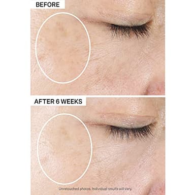 StriVectin Multi-Action Super-C SPF 30 Vitamin C Moisturizer and Daily Sunscreen for Brightening and Smoothing Fine Lines, 1.7 Fl Oz - Image 9