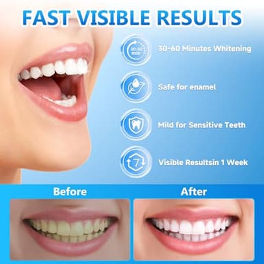Milumber Teeth Whitening Strips for Sensitive, 42 Strips Whitener Safe Whitestrip, Deep Stains Removal Tooth Whitening, Enamel Safe Non-Slip Dry Strip Technology for Whiter Teeth, Mint - Image 2