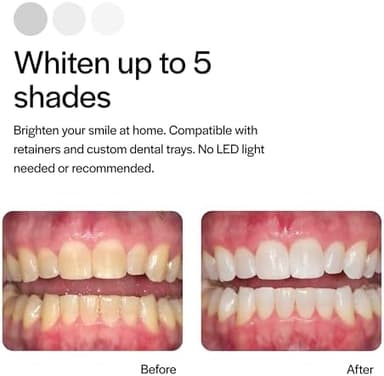 Opalescence 15% Gel Syringes Teeth Whitening Refill Kit - Low Sensivity (4 Syringes) - Cool Mint - Carbamide Peroxide - Made in The USA by Ultradent Tooth Whitening 5195-2 - Image 5
