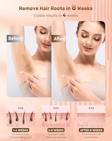 VivaEase Laser Hair Removal, 999,900+ Flashes IPL Hair Removal Device for Women and Men, Ice-Cooling Painless Laser Hair Removal, At-Home Hair Remover for Armpits Back Facial Legs Arms Bikini Line - Image 5