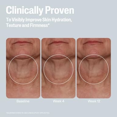 Cetaphil Skin Activator Hydrating & Firming Body Cream 12oz, Mandelic Acid (AHA) and Centella Asiatica (CICA) Cream, Hydrates and Firms Aging Skin, Anti-Aging Skincare, 12 oz - Image 5