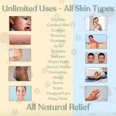 Beef Tallow Balm for Skin | NAKED TALLOW BALM | 1 Ingredient - 100% Grass Fed Tallow | Whole Body & Face Moisturizer | Whipped & UNSCENTED for Sensititve Dry Skin, Babies, Eczema, Psoriasis, Rosacea (2oz) - Image 6