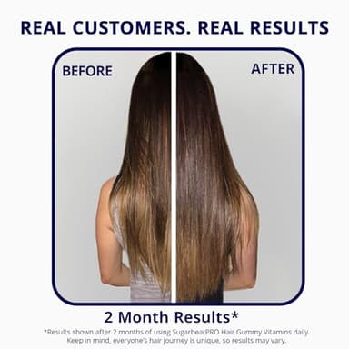 Sugarbear Hair Vitamin Gummy 2 Month Supply Extra Strength Biotin 6000mcg, Growth for Men & Women, Vegan Vitamin B12, MSM, Inositol, Omega 3, Elderberry, Certified Kosher, Halal, Cruelty-Free - Image 7