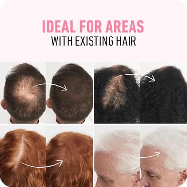 BOLDIFY Hair Fibers (56g) - Fill In Thinning and Fine Hair for an Instantly Fuller, Thicker Look - 14 Shades for Women & Men - Black - Image 4