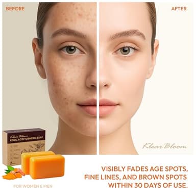 KlearBloom Kojic Acid Soap, Turmeric Soap Bar for Dark Spots Brightening & Moisturizing with Collagen, Vitamin E, Retinol, Hyaluronic Acid, Shea Butter, Paraben & Sulfate-Free 105g x 2 Bars - Image 2