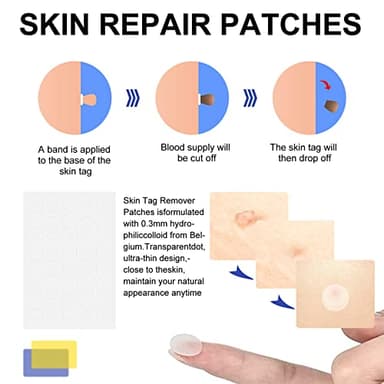 Skin Tag Remover, FDA-Cleared Skin Tag Removal Kit Device, Safe and Effective Home Use (Yellow) - Image 5