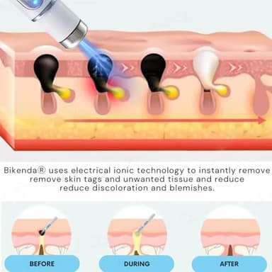 Bikenda Pen Kit,Smoothes Skin and Reduces Skin Blemishes (1 PCS) - Image 7