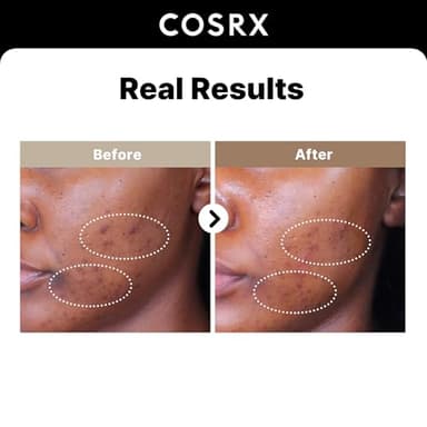 COSRX 2% Alpha Arbutin Discoloration Care Face Serum with Niacinamide, Glutathione & Tranexamic Acid, 1.7 fl oz – Serum for Face, Korean Skin Care - Image 2