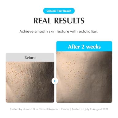 EQQUALBERRY Swimming Pool Toner - Korean Toner for Daily Exfoliating & Deep Hydration with Natural Enzyme Protease & Hyaluronic Acid, For Sensitive Skin, 10.14 Fl Oz (300ml) - Image 7