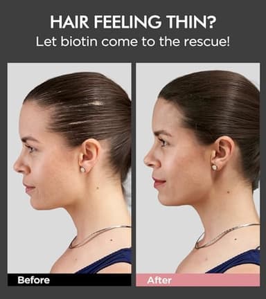 Hair Growth Biotin Shampoo and Conditioner Set, Onion Anti-Loss Volumizing Moisturizing Treatment for Soft Shine Hair, Rosemary Clarifying Dandruff Shampoo for Women Men, 2 x 16.9oz - Image 2