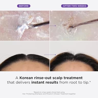 Dr. Groot Miracle in Shower Treatment, Korean Hair Care, 5 Seconds to Smooth Hair, Rosemary Oil for Healthier-Looking Hair, Hair Rinse, Moisturizing Hair Treatment, Kbeauty Scalp Revitalizing Solution - Image 2
