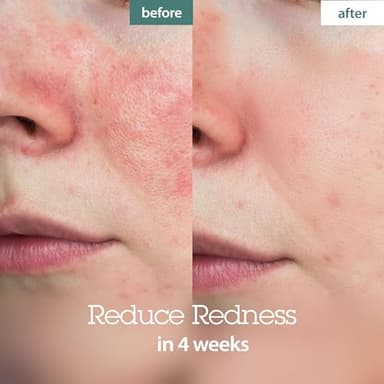 BLITHE Pressed Serum Crystal Iceplant Face Moisturizing Gel - Kbeauty Best Skin Cream for Dry Skin, Korean Serum for Combination Skin & Redness Relief, Face Moisturizer for Dry Skin Cream 1.68 Oz - Image 3