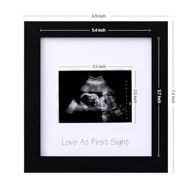eletecpro Ultrasound Picture Frame with Real Glass Cover and 3 Different Mats, 7x7 Baby Keepsake Frame for 3x4 Inches Sonogram Photo, Wall Mount or Tabletop Display, Pregnancy Announcement, Black - Image 3