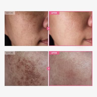 TOSOWOONG Arbutin 7% + Tranexamic Acid 4% Cream, 70,000ppm Arbutin, 40,000ppm TXA, Niacinamide, Glutathione, Dark Spots, Freckle, Blemishes, Pigmentation, Korean Skin Care, 50ml, 1.69 fl.oz. - Image 2