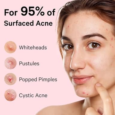 Sosky Pimple Patches for Face, Invisible Hydrocolloid Acne Patches, HSA Store Eligible Items, Zit Sticker for Face and Skin, Pimple Sticker for Covering Zits, Blemishes with Salicylic Acid 48 Count - Image 7