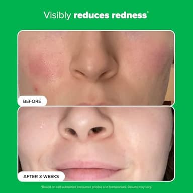 Paula's Choice BOOST 10% Azelaic Acid Booster Cream Gel Face Serum with Salicylic Acid, Oil-Free Skin Brightening Serum for Face, Fragrance-Free, 1oz - Image 6