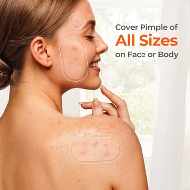 TKTK 443 Count Pimple Patches for Face, Hydrocolloid Acne Patch Bulk, Acne Stickers for Covering Cheeks, Forehead, Chin Blemishes Zit Breakouts for All Skin Types (Dots, Strip, Contoured 5 Sizes) - Image 8