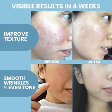 Collagen Peptide Serum for Face – Anti Aging Facial Treatment with Peptides & Hyaluronic Acid – Gentle Formula for Sensitive Skin, Microneedling Pen, Derma Roller, Skin Firming & Hydrating (2 Oz) - Image 3