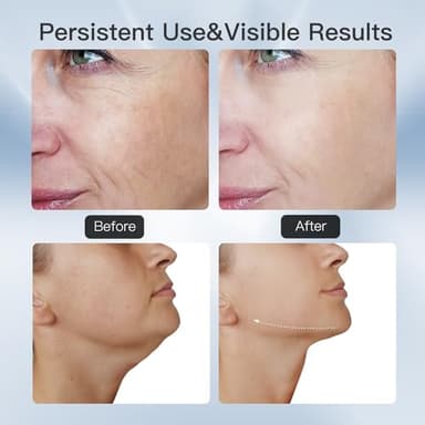 3-in-1 Beauty Massager for Face and Neck, Based on Triple Action LED, Thermal, and Vibration Technologies for Skin Care,Improve,Firm,Tightening and Smooth - Image 6