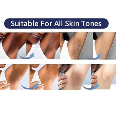 Vcetree Skin Bleaching Cream Skin Lightening for Body Intimate Areas, Private Parts, Underarm, Knees, Elbows, Inner Thigh, Bikini Area, Whitening Cream Dark Spot Remover For Intimate Areas (1FL OZ) - Image 4