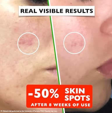 Vitamin C Serum For Face – Anti-Aging Facial Serum with Vitamin C, Hyaluronic Acid, Niacinamide, B5 & Vit E. Brightening Facial Essence for Dark Spots, Fine Lines, Wrinkles & Glowing Skin, 2 Fl Oz - Image 4