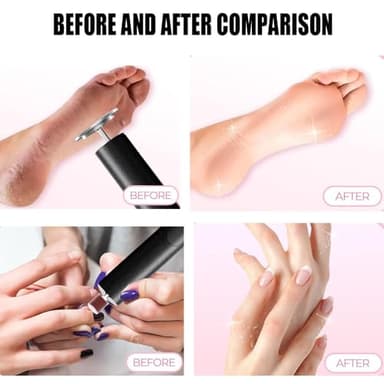Cordless Electric Callus Remover for Feet with Nail File Sander 2 in 1 Rechargeable Foot File Grinder for Dead Skin Crack Dry Calluses with Sandpaper Disk 6 Speed Adjustable - Image 9