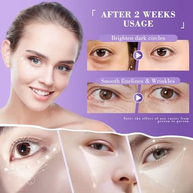 Eye Cream, Retinol Eye Cream for Dark Circles, Puffiness Anti Aging, With Hyaluronic Acid, Peptides, Caffeine Reduces Bags, Smooths Wrinkles & Fine Lines, Dark Circles Under Eye Treatment - Image 6