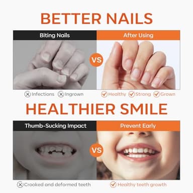 modelones Nail Biting Treatment for Kids Thumb Sucking Deterrent Quick Dry Nail Biting Prevention Bitter No Bite Nail Polish for Nail Care Stop Biting Nails Repair for Damaged Nails 0.34 fl oz - Image 2