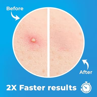 PatchRx Pimple Patches for Face (120 Patches), Hydrocolloid Acne Patches with Tea Tree Oil, Pimple Patch Pimple Stickers - Hydrocolloid Patch Acne Dots - Acne Pimple Patches For Face - Zit Patches - Image 4
