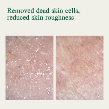 Pyunkang Yul PKY Ultimate Calming Solution Ampoule for Sensitive Skin with Patented Ingredients, Serum Intensely Calms & Soothes Redness with Cica & Tea Tree, Korean Skincare (1.01 Fl. Oz, 30ml) - Image 5