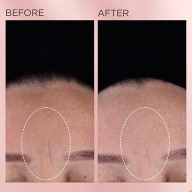 Elizabeth Arden Retinol + HPR Ceramide Rapid Skin Renewing Anti-Aging Face Serum Capsules, Fine Lines & Wrinkles Treatment with Peptides, Vitamin E, & Niacinamide, 90 Count - Image 8