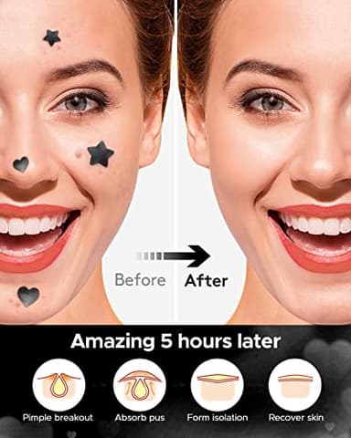 LitBear Acne Patch Pimple Patch, Black Star & Heart Shaped Acne Absorbing Cover Patch, Hydrocolloid Acne Patches For Face Zit Patch Pimple Sticker Acne Dots, Tea Tree Oil + Centella (108 Count) - Image 7