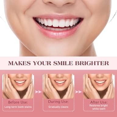 SP-8 Probiotic Ultra Whitening Toothpaste Upgraded, SP-8 New Version Fluoride-Free & Probiotic-Infused Formula for Oral Health, Teeth Whitening & Gum Care & Fresh Breath Probiotic Toothpaste for Adult - Image 3