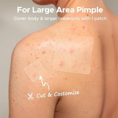 TKTK Large Pimple Patches, 60 mm XL Acne Patches, Big Hydrocolloid Bandages for Body, Face, Forehead, Chin, Neck Zit Breakouts, Hydrocolloid Patch (Square, Strip, Dot 5 Sizes 62 Count) - Image 3