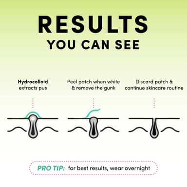 Dots for Spots Pimple Patches For Face - Stocking Stuffers For Teens - Fast Acting, Translucent Hydrocolloid Zit Patches that Unclog Pores Korean Skin Care - Vegan, Cruelty Free - (60 count) - Image 3