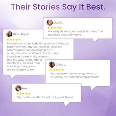 Retinol Eye Cream for Dark Circles and Puffiness, Hydrating Under Eye Cream for Dark Circles, Anti Aging Dark Circle Eye Cream for Fine Lines, Wrinkles, Firming Eye Contour, 1.06 oz - Image 5