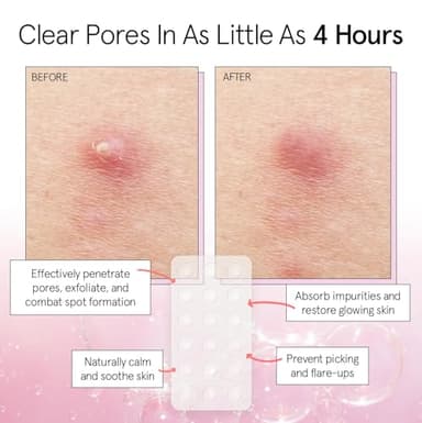grace & stella Award Winning Pore Strip Pimple Patches for Face - Hydrocolloid Acne Patches for Shrinking Zits, Whiteheads - Spot Stickers - Dermatologist-Tested, Vegan (Invisible, 72 Count) - Image 3