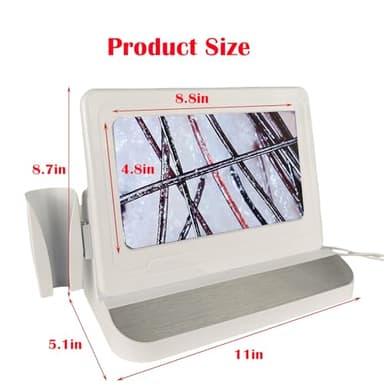 Professional Scalp Camera with 11-Inch HD Screen - High-Definition Hair & Scalp Analysis Device for Salons and Spas, Easy to Use with Memory Storage, Ideal for Scalp Treatments & Client Consultations - Image 5