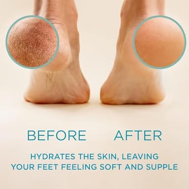 Lee Beauty Professional Callus Remover for Feet - Original, Powerful Formulation - Extra Strength Gel, Home Pedicure Foot Spa Results - Cracked & Dead Dry Skin Supplies - 8 Oz - Image 2