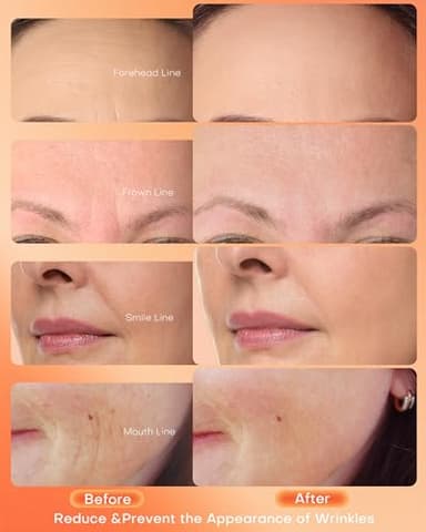 NEWKEY Red Light Therapy Mask for Face,7 Colors LED Face Mask Light Therapy, At-Home Photon Skin Care Beauty Mask for Anti Wrinkles Acne Reduction - Image 3