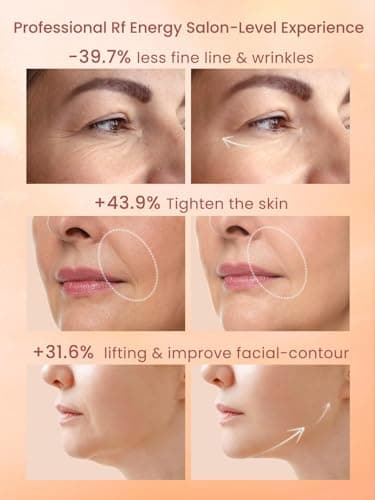 Radio Frequency Skin Tightening Device, Anti-Aging Face Machine for Wrinkle Removal, Lifting & Firming, Wireless Home Beauty Device with 3 Levels, at-Home Skin Renewal - Image 2