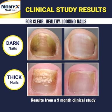 NONYX Fungal Nail Clarifying Gel | Clinically Proven for Discolored, Thick, Brittle, Yellow, Lifted, and other signs of Fungus-Damaged Toenails | 90% of Nails Improve | Over 8 million sold - Image 4