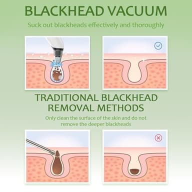 Blackhead Remover Vacuum - Black Head Remover for Face,Blackhead Extractor Tool with 3 Adjustable Suction Levels,4 Probes,USB Interface Type Pore Vacuum,Suitable for Women and Men (White) - Image 7