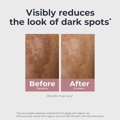 Eucerin Radiant Tone Dual Serum Dark Spot Corrector, Dark Spot Serum with Thiamidol and Hyaluronic Acid, Helps Visibly Reduce the Look of Persistent Dark Spots, 1 Fl Oz Bottle - Image 5